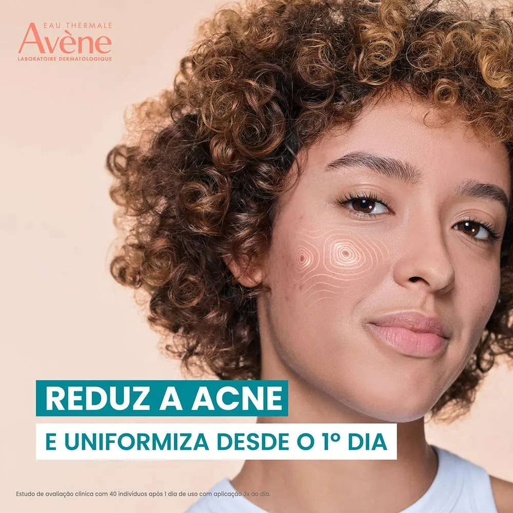 Creme Facial Acelerador Antiacne Avène Cleananance Comedomed Peeling 40mlCreme Facial Acelerador Antiacne Avène Cleananance Comedomed Peeling 40mlv - Image 3